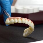 most-protetyczny-czy-implant