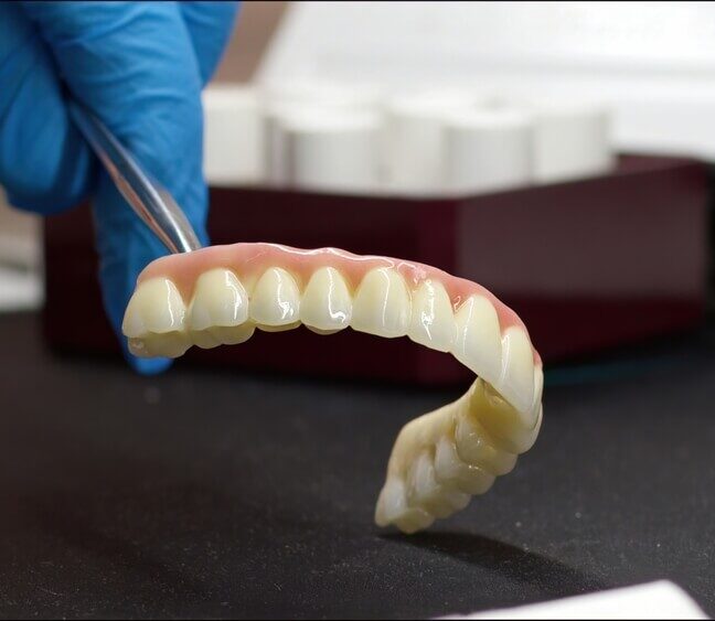 most-protetyczny-czy-implant